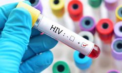 Dünyada İkinci Vaka!  HIV Virüslü Hasta İyileşti