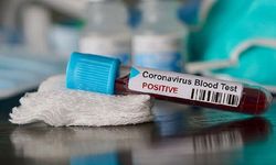 Sağlık Bakanlığı'ndan koronavirüs testleriyle ilgili iddialar hakkında açıklama